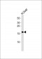 GLRX5 Antibody (Center)
